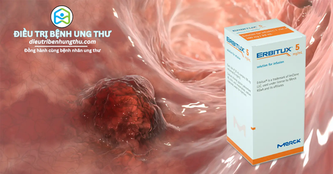 Liệu Pháp Cetuximab: Đột Phá Trong Điều Trị Ung Thư Đại Trực Tràng Và Ung Thư Tế Bào Ở Đầu, Cổ Đang Được Cộng Đồng Y Khoa Chào Đón