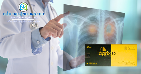 Tagrix (Osimertinib): Cách Mạng Điều Trị Ung Thư Phổi, Mở Ra Tương Lai Mới Cho Bệnh Nhân